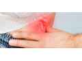 can-you-prevent-a-hernia-tips-for-a-healthy-abdomen-healthy-lifestyle-small-0