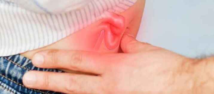 can-you-prevent-a-hernia-tips-for-a-healthy-abdomen-healthy-lifestyle-big-0
